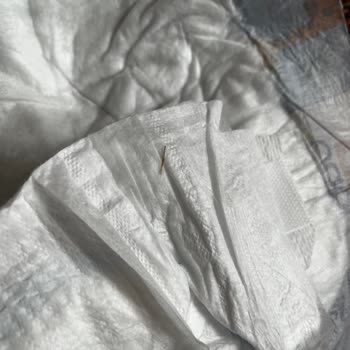 Bebek Bezinde Tehlikeli Yabancı Cisim Şoku