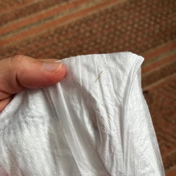 Bebek Bezinde Tehlikeli Yabancı Cisim Şoku