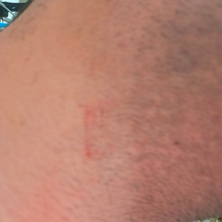 Tıraş Makinesi Cildimi Tahriş Ediyor, Para İadesi İstiyorum