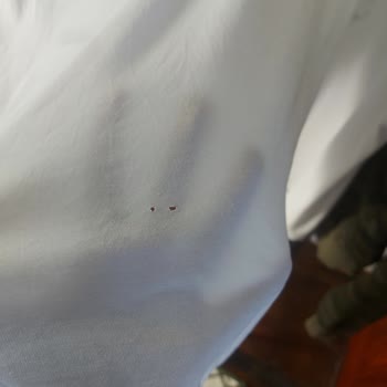 Yeni Alınan Çamaşır Makinesi Sürekli Çamaşırlarda Delik Oluşturuyor, Çözüm Bekliyorum