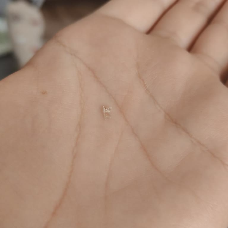 Dr. Oetker Çikolatalı Pudingde Cam Parçası Tehlikesiyle Karşılaştım, Sağlığım Riske Girdi