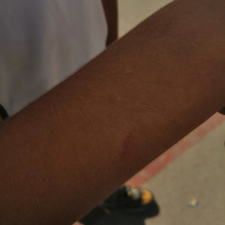 Okulda Çocuğuma Uygulanan Şiddet Ve Yetersiz Müdahale