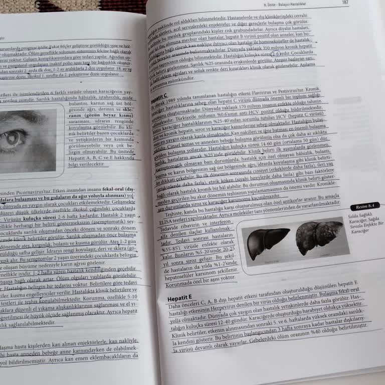 Gardrops'tan Aldığım Kusurlu Kitaplar Ve İade Sorunu