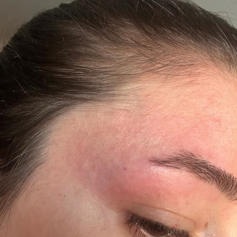 Kaşımın Şekli Bozuldu Ve Hatalı İşleme Ücret Alındı