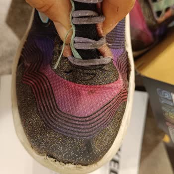 Kısa Sürede Deforme Olan Çocuk Ayakkabısına Ret Yanıtı Ve Çözüm Sunulmaması