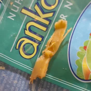 Makarnadan Çıkan Yabancı Cisim Boğulma Tehlikesi Yaşattı