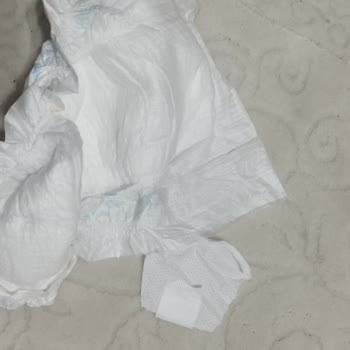 Molfix 5 Numara Bezlerde Yapışkanlı Kenarların Kopması Mağduriyet Yarattı