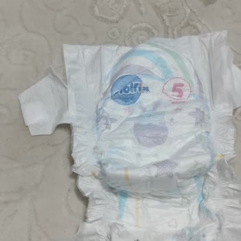 Molfix 5 Numara Bezlerde Yapışkanlı Kenarların Kopması Mağduriyet Yarattı