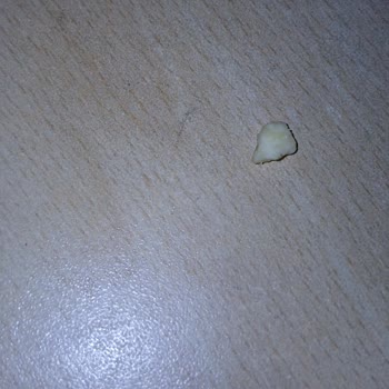 Patates Cipsinden Diş Kadar Sert Yenemeyen Parçalar Çıktı