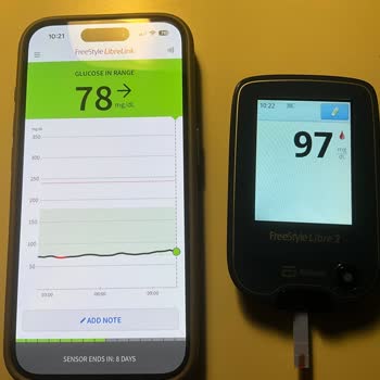 Freestyle Libre 2 Plus Sensörü Yanlış Ölçüm Yapıyor, Güven Kaybı Yaşadım