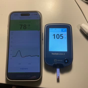 Freestyle Libre 2 Plus Sensörü Yanlış Ölçüm Yapıyor, Güven Kaybı Yaşadım