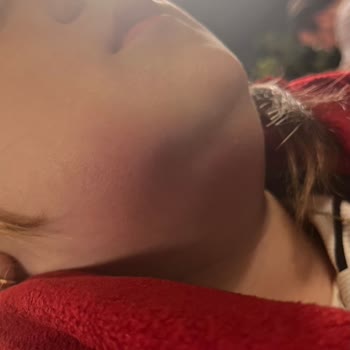 Diş Çekimi Sonrası Bilgilendirme Ve Çözüm Eksikliği Küçük Çocuğu Mağdur Etti