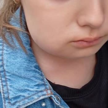 Diş Çekimi Sonrası Bilgilendirme Ve Çözüm Eksikliği Küçük Çocuğu Mağdur Etti