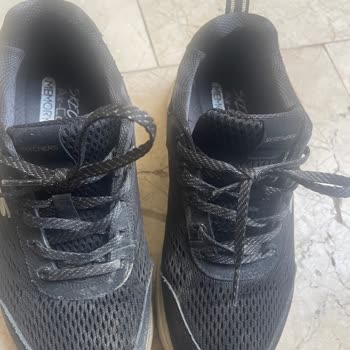 Skechers Aldığım Ayakkabı Ayağımı Yaraladı, Firma İlgisiz Kaldı