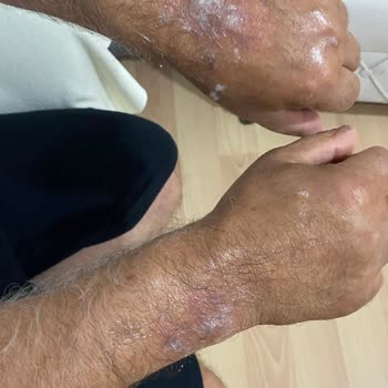 Mini Fırında Aniden Kırılan Tel Ciddi Güvenlik Riski Oluşturdu