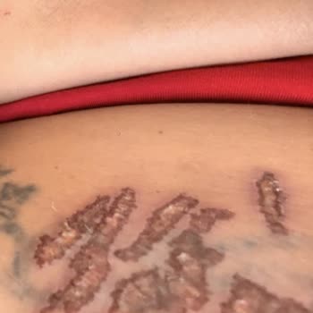 Hugua Estetik & Güzellik Verilen Vaatlerin Yerine Getirilmemesi