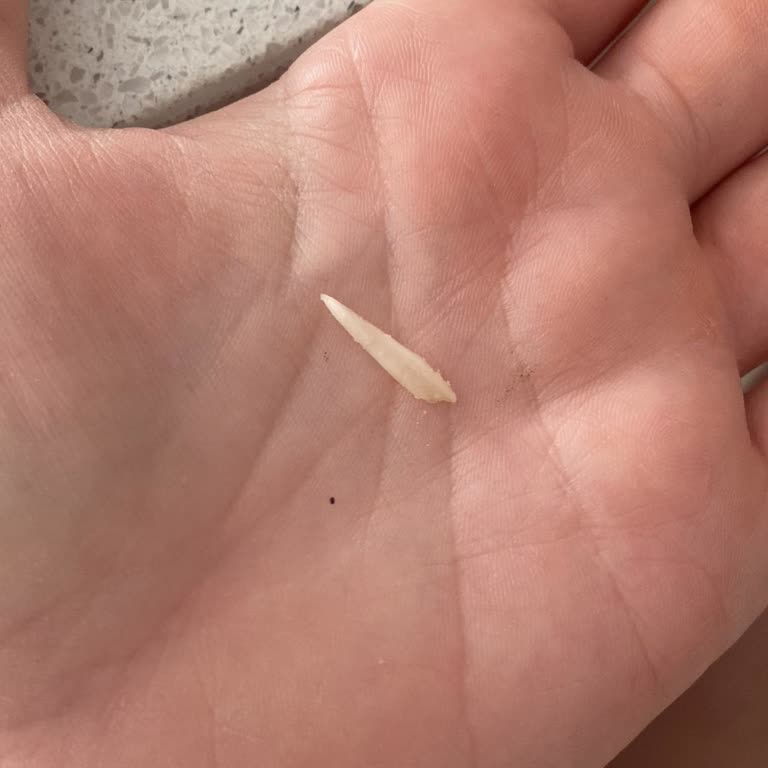 Nutella'nın İçinden Çıkan Yabancı Cisim Nedeniyle Yaşadığım Rahatsızlık