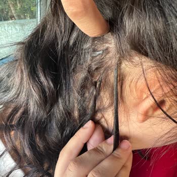 Kötü Mikro Kaynak Deneyimi Ve İlgisiz Hizmet