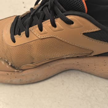 Kısa Sürede Açılan Dikişler Ve Olumsuz Garanti Sonucu Hayal Kırıklığı Yarattı