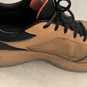 Kısa Sürede Açılan Dikişler Ve Olumsuz Garanti Sonucu Hayal Kırıklığı Yarattı