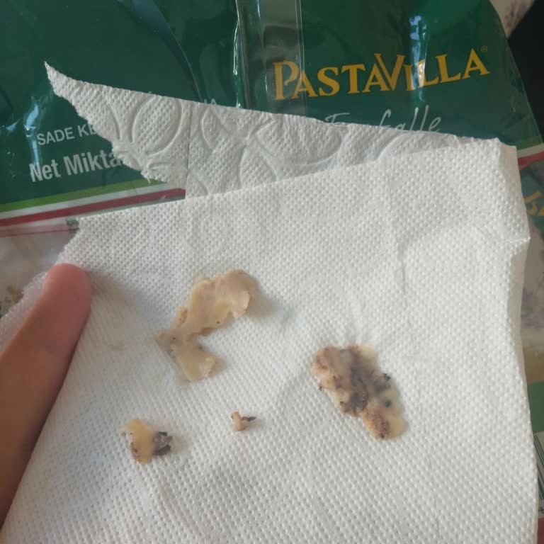Pastavilla Kelebek Makarna İçinde Siyah Maddelerle Karşılaştım