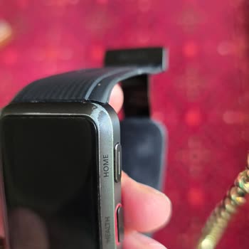 Huawei Servis Sonrası Akıllı Saatimde Oluşan Çizik Ve Deformasyon Mağduriyeti