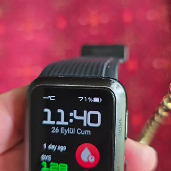 Huawei Servis Sonrası Akıllı Saatimde Oluşan Çizik Ve Deformasyon Mağduriyeti