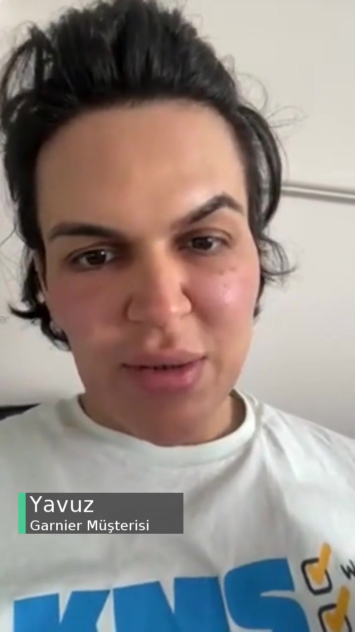 Garnier Hyaluronik Alır Günlük Nemlendirici Jel Yüzümü Mahvetti! videonun kapak resmi