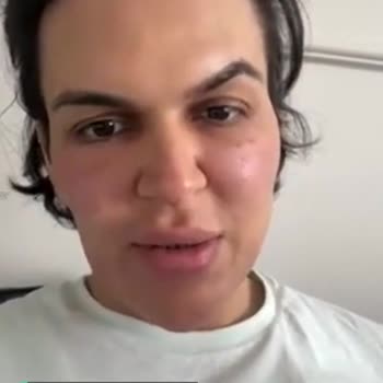 Garnier Hyaluronik Alır Günlük Nemlendirici Jel Yüzümü Mahvetti!