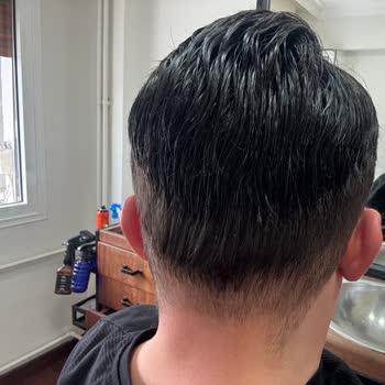 Protez Saçta Kesim Ve Renk Uyumsuzluğu Mağduriyeti