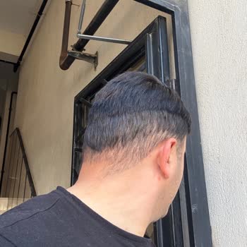 Protez Saçta Kesim Ve Renk Uyumsuzluğu Mağduriyeti