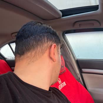 Protez Saçta Kesim Ve Renk Uyumsuzluğu Mağduriyeti