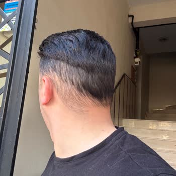 Protez Saçta Kesim Ve Renk Uyumsuzluğu Mağduriyeti