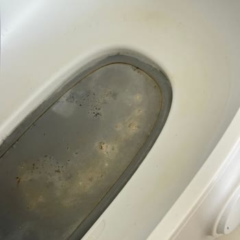 Philips Avent Sterilizasyon Makinesinde Kısa Sürede Kararma Ve Deformasyon