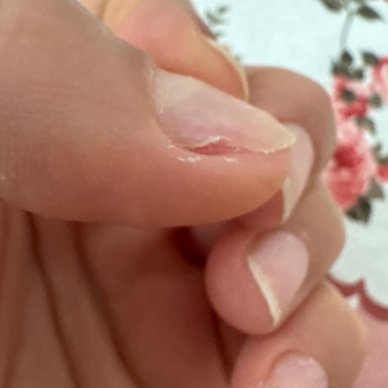 Protez Tırnak Hizmetinden Memnun Kalmadım, İade Talep Ediyorum