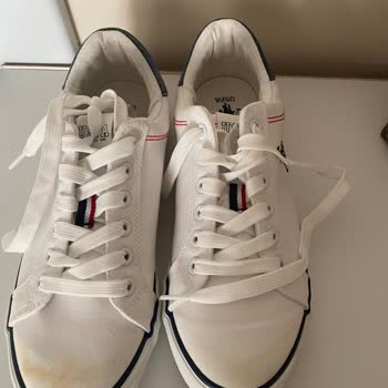 Kısa Sürede Deforme Olan Ayakkabıda Değişim Veya İade Talebim Reddedildi