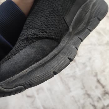 Skechers Ayakkabıda Hızlı Deformasyon Ve Amazon İle Skechers Türkiye'nin İlgisizliği