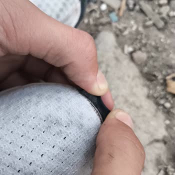 Garanti Kapsamında Ayakkabı Deformasyonu Ve İade Talebinin Reddedilmesi