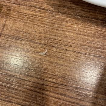 Restoranda Yemeğimde Tırnak Buldum Personel İlgisiz Kaldı