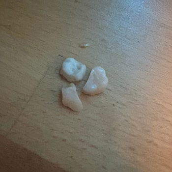 Alanya Dental Center Sorumluluk Almadı!