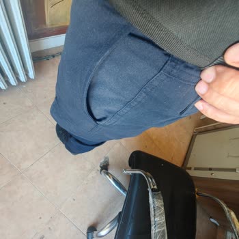 Garanti Dışı Bırakılan Pantolonun Renk Solması Sorunu