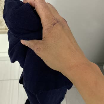 Kalitesiz Ürünler Ve İade Sorunu Yüzünden Yaşadığım Mağduriyet