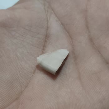 BİM'den Alınan Pirinçte Fayans Parçası: Gıda Güvenliği Riski Ve Sağlık Sorunu