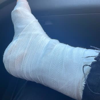 Güvenlik Uyarısı Olmayan Başlık Nedeniyle Parmağım Yaralandı, Acil Önlem İstiyorum