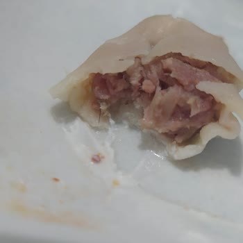 Dondurulmuş Mantıdan Kıl Çıkması Nedeniyle Hijyen Sorunu Ve İade Talebi