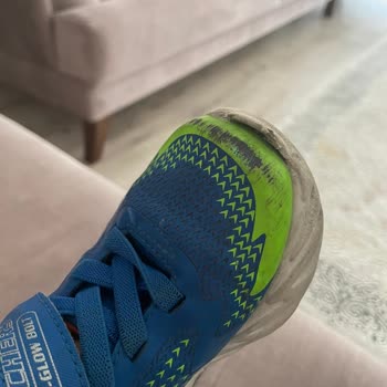 Kısa Sürede Aşınan Ayakkabı Ve Yetersiz Müşteri Hizmetiyle Hayal Kırıklığı