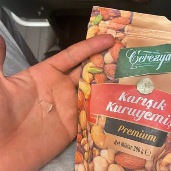 Kuruyemişten Çıkan Cam Parçası Güvenlik Endişesi Yarattı