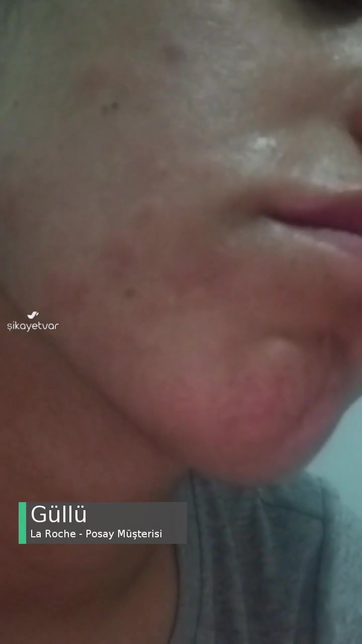 La Roche - Posay Cildim Çok Kötü Bir Hale Geldi videonun kapak resmi