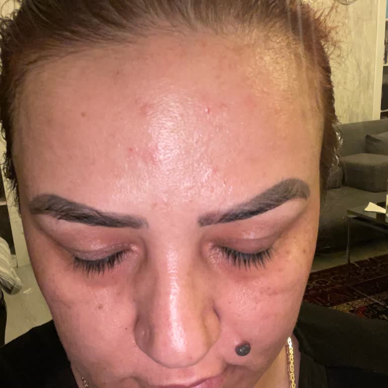 Isana Vitamin C Ürünü Cildimde Yoğun Reaksiyona Sebep Oldu