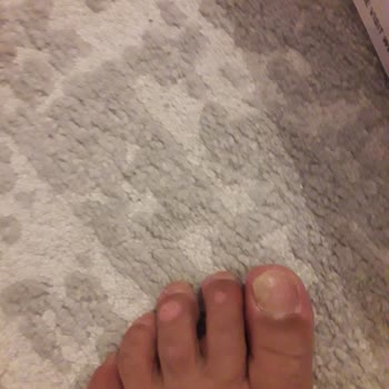 Aldığım Skechers Ayakkabı Ayağımda Ağrı Yaptı, Değişim Talep Ediyorum